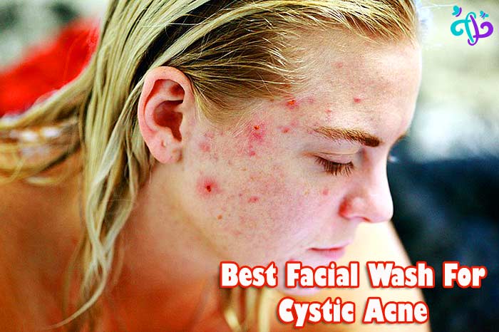 Best Facial Wash For Cystic Acne