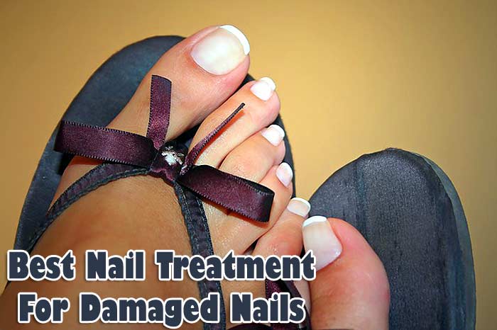 Best nail treatment for damaged toe-nails